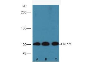 Lane A: Mouse testis lysates Lane B: Mouse kidney lysates Lane C: Mouse pancreas lysates. (ENPP1 antibody  (AA 41-140))