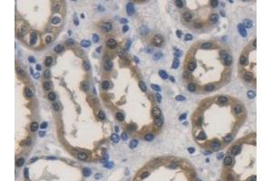 Detection of ALDH1A1 in Human Kidney Tissue using Polyclonal Antibody to Aldehyde Dehydrogenase 1 Family, Member A1 (ALDH1A1) (ALDH1A1 antibody  (AA 2-501))