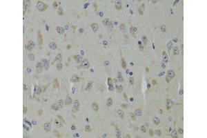 Immunohistochemistry of paraffin-embedded Mouse brain using RPL9 Polyclonal Antibody at dilution of 1:100 (40x lens). (RPL9 antibody)