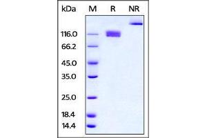 Mouse M-CSF R, Fc Tag, low endotoxin on SDS-PAGE under reducing (R) and no-reducing (NR) conditions.