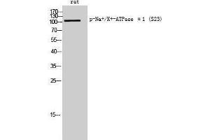 Western Blotting (WB) image for anti-Sodium Potassium ATPase, alpha1 (ATP1A1) (pSer23) antibody (ABIN3182451)