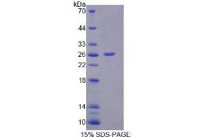 SDS-PAGE (SDS) image for Interleukin 17D (IL17D) (AA 76-274) protein (His tag) (ABIN6239142) (IL17D Protein (AA 76-274) (His tag))