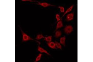 ABIN6275345 staining A549 by IF/ICC. (EHHADH antibody  (Internal Region))