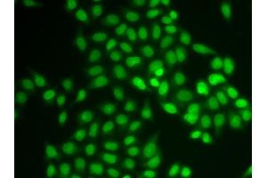 Immunofluorescence analysis of U2OS cells using UBE2V1 antibody (ABIN5973735).