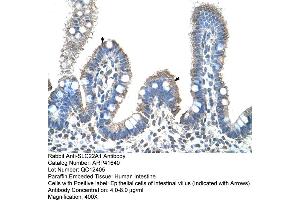 Rabbit Anti-SLC22A1 Antibody  Paraffin Embedded Tissue: Human Intestine Cellular Data: Epithelial cells of intestinal villas Antibody Concentration: 4. (SLC22A1 antibody  (C-Term))