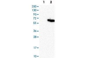 Western Blot analysis of Lane 1: negative control (vector only transfected HEK293T cell lysate) and Lane 2: over-expression lysate (co-expressed with a C-terminal myc-DDK tag in mammalian HEK293T cells) with STK11 polyclonal antibody . (LKB1 antibody)