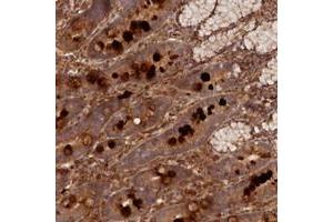 Immunohistochemical staining of human duodenum with LRRC38 polyclonal antibody  shows strong cytoplasmic positivity in glandular cells. (LRRC38 antibody)