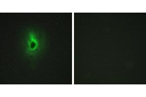 Peptide - +Immunohistochemistry analysis of paraffin-embedded human breast carcinoma tissue using Collagen VI α3 antibody. (COL6a3 antibody)