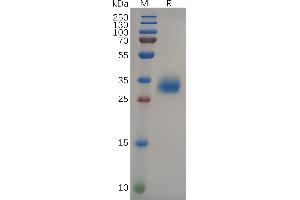 SDS-PAGE (SDS) image for SARS-CoV-2 Spike (B.1.617.2 - delta), (RBD) protein (His tag) (ABIN7490599)