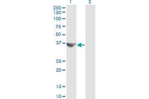Western Blot analysis of CCNG2 expression in transfected 293T cell line by CCNG2 monoclonal antibody (M01), clone 1F9-C11. (Cyclin G2 antibody  (AA 1-344))