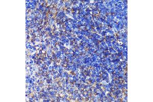 Immunohistochemistry of paraffin-embedded Rat spleen using SW Rabbit pAb (ABIN7270654) at dilution of 1:100 (40x lens). (SWAP70 antibody  (AA 316-585))