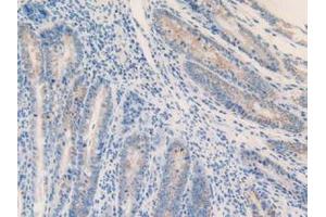 IHC-P analysis of Mouse Intestine Tissue, with DAB staining. (MGST1 antibody  (AA 8-155))