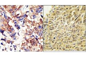 Image no. 2 for anti-Ubiquilin 2 (UBQLN2) (AA 28-57), (N-Term) antibody (ABIN357609) (Ubiquilin 2 antibody  (N-Term))