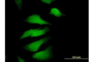 Immunofluorescence of monoclonal antibody to EDIL3 on HeLa cell. (EDIL3 antibody  (AA 101-199))