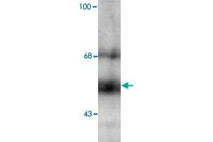 Western blot of hippocampal lysate showing specific immunolabeling of the ~58k THRB protein. (THRB antibody  (N-Term))