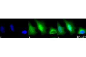 Immunocytochemistry/Immunofluorescence analysis using Rabbit Anti-SOD (Cu/Zn) Polyclonal Antibody . (SOD1 antibody  (Atto 594))