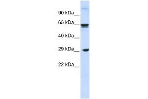 WB Suggested Anti-CLEC4M Antibody Titration:  0. (C-Type Lectin Domain Family 4, Member M (CLEC4M) (N-Term) antibody)