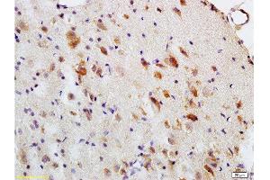 Formalin-fixed and paraffin embedded: rat brain tissue labeled with Anti-MBP Polyclonal Antibody , Unconjugated at 1:200, followed by conjugation to the secondary antibody and DAB staining (MBP antibody  (AA 69-85))