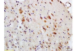 Formalin-fixed and paraffin embedded: rat brain tissue labeled with Anti-MBP Polyclonal Antibody , Unconjugated at 1:200, followed by conjugation to the secondary antibody and DAB staining (MBP antibody  (AA 69-85))