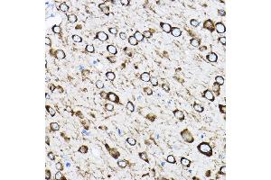 Immunohistochemistry of paraffin-embedded mouse brain using RPL17 Rabbit pAb (ABIN6128342, ABIN6147115, ABIN6147116 and ABIN6221632) at dilution of 1:100 (40x lens). (RPL17 antibody  (AA 1-184))
