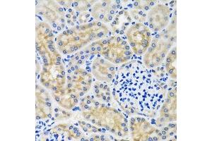Immunohistochemistry of paraffin-embedded mouse kidney using ANTXR2 antibody. (ANTXR2 antibody  (AA 339-488))