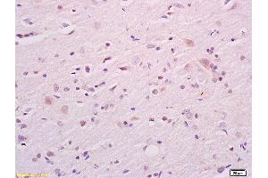Formalin-fixed and paraffin embedded rat brain tissue labeled with Anti CKAP4 Polyclonal Antibody,Unconjugated (ABIN717506) at 1:200 followed by conjugation to the secondary antibody and DAB staining. (CKAP4 antibody  (AA 525-602))