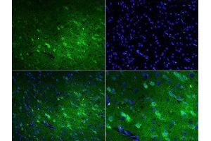 Formalin-fixed and paraffin embedded rat brain labeled with Rabbit Anti-Talin Polyclonal Antibody, FITC Conjugated at 1:200 for 60 minutes.