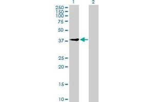 Western Blot analysis of UEVLD expression in transfected 293T cell line by UEVLD MaxPab polyclonal antibody.