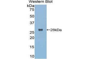 Western Blotting (WB) image for anti-Transmembrane Protease, serine 2 (TMPRSS2) (AA 284-492) antibody (ABIN1860781)