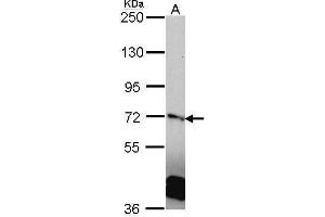 WB Image Sample (30 ug of whole cell lysate) A: A431 , 7. (RANGAP1 antibody  (N-Term))