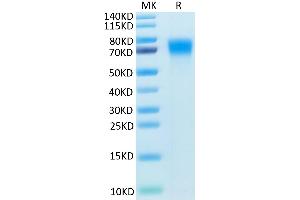 Mouse DR6 on Tris-Bis PAGE under reduced condition. (TNFRSF21 Protein (AA 42-349) (His tag))