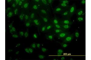 Immunofluorescence of monoclonal antibody to FAF1 on HeLa cell. (FAF1 antibody  (AA 551-650))