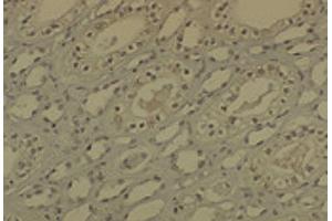 Immunohistochemistry analysis using Mouse Anti-DNMT1 Monoclonal Antibody, Clone 60B1220. (DNMT1 antibody  (AA 637-650) (PE))