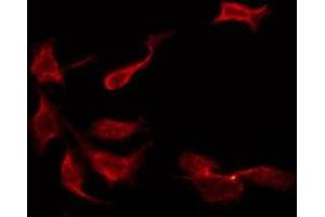 ABIN6274933 staining Hela by IF/ICC. (KCNMB2 antibody  (Internal Region))