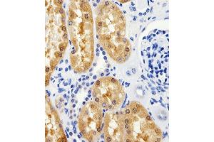 Immunohistochemical analysis of paraffin-embedded H. (ALT antibody  (N-Term))