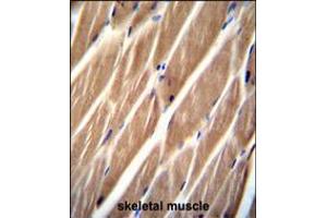 PIP5KL1 Antibody immunohistochemistry analysis in formalin fixed and paraffin embedded human skeletal muscle followed by peroxidase conjugation of the secondary antibody and DAB staining. (PIP5KL1 antibody  (N-Term))