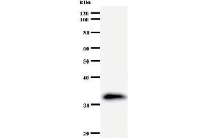 Western Blotting (WB) image for anti-Eukaryotic Translation Initiation Factor 3 Subunit K (EIF3K) antibody (ABIN932454) (EIF3K antibody)
