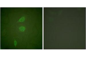 Immunofluorescence analysis of NIH/3T3 cells, using HDAC5 antibody (ABIN5976423). (HDAC5 antibody  (C-Term))