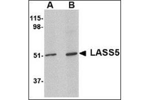Western blot analysis of LASS5 in SK-N-SH lysate with this product at (A) 1 and (B) 2 μg/ml. (LASS5 antibody  (N-Term))