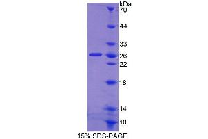SDS-PAGE (SDS) image for Carnitine O-Octanoyltransferase (CROT) (AA 410-612) protein (His tag) (ABIN4989229) (CROT Protein (AA 410-612) (His tag))