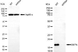 anti-Destrin (Actin Depolymerizing Factor) (DSTN) antibody
