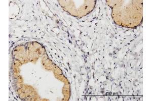 Immunoperoxidase of purified MaxPab antibody to PGF on formalin-fixed paraffin-embedded human uterine cervix. (PLGF antibody  (AA 1-170))