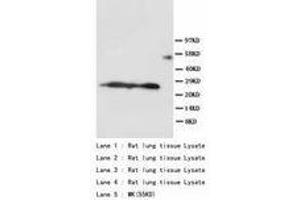 Image no. 1 for anti-Surfactant Protein A1 (SFTPA1) (AA 221-236) antibody (ABIN1493415)