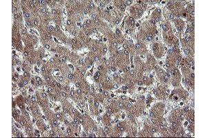 Immunohistochemical staining of paraffin-embedded Human liver tissue using anti-TBCC mouse monoclonal antibody. (TBCC antibody)