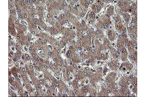 Immunohistochemical staining of paraffin-embedded Human liver tissue using anti-TBCC mouse monoclonal antibody.