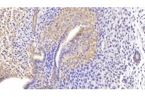 Detection of ITGa1 in Mouse Uterus Tissue using Polyclonal Antibody to Integrin Alpha 1 (ITGa1) (Integrin alpha 1 antibody  (AA 103-368))