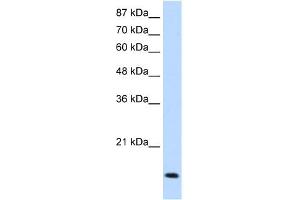 WB Suggested Anti-MYC Antibody Titration:  1.