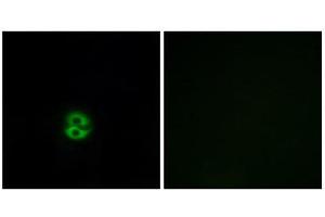 Immunofluorescence (IF) image for anti-Carbohydrate (N-Acetylglucosamine 6-O) Sulfotransferase 6 (CHST6) (C-Term) antibody (ABIN1850996)