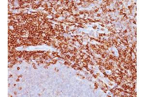 Formalin-fixed, paraffin-embedded human spleen stained with CD43 Mouse Monoclonal Antibody (DF-T1). (CD43 antibody)