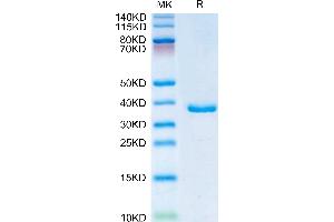 IGFBP2 Protein (AA 36-325) (His tag)